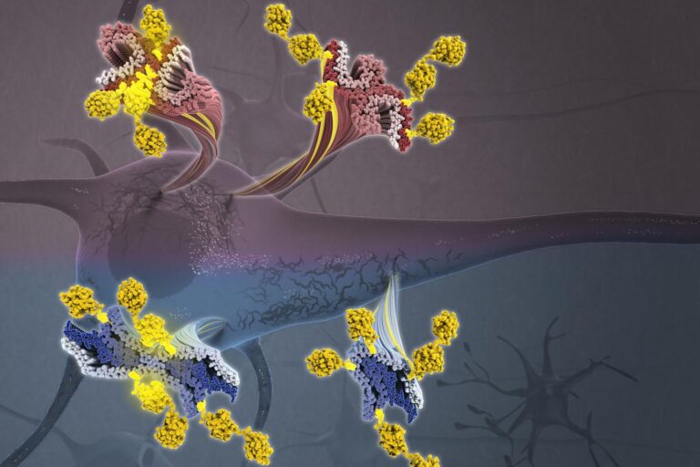 علائم و تشخیص بیماری آلزایمر