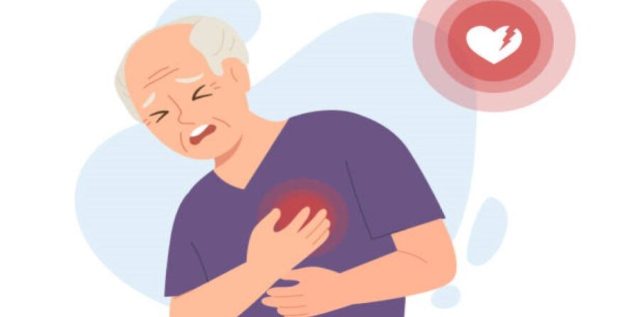 حمله قلبی سکته قلبی چیست ؟ حمله قلبی سکته قلبی چیست ؟