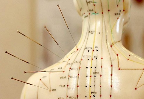 طب سوزنی در سالمندان