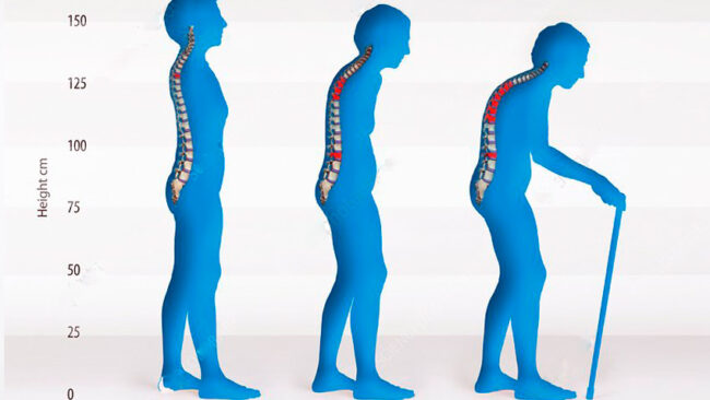 تغییر بدن در سالمندی بنیاد فرهنگ سالمندی