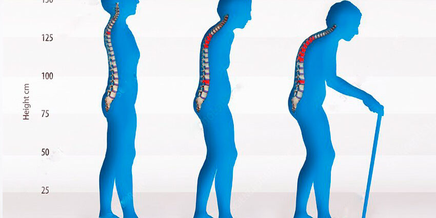 تغییر بدن در سالمندی بنیاد فرهنگ سالمندی