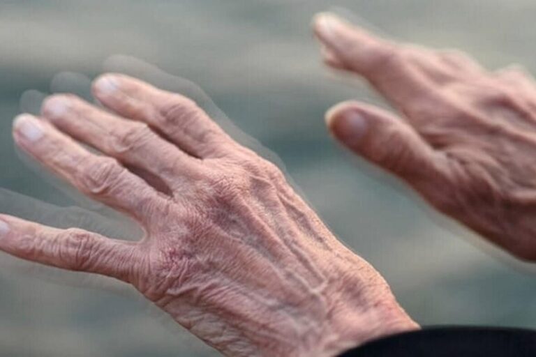 از بیماری پارکینسون چه می دانید؟