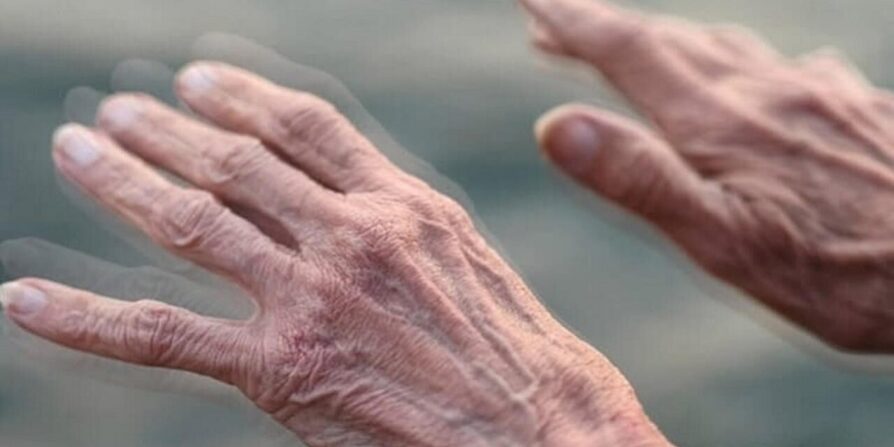 از بیماری پارکینسون چه می دانید؟